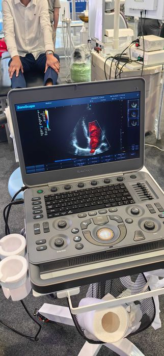 портативный узи аппарат SonoScape x3 (портативная УЗИ система)
