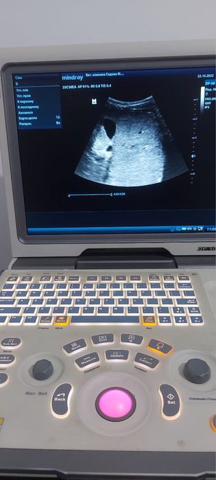 УЗИ аппарат Миндрай Dp-50