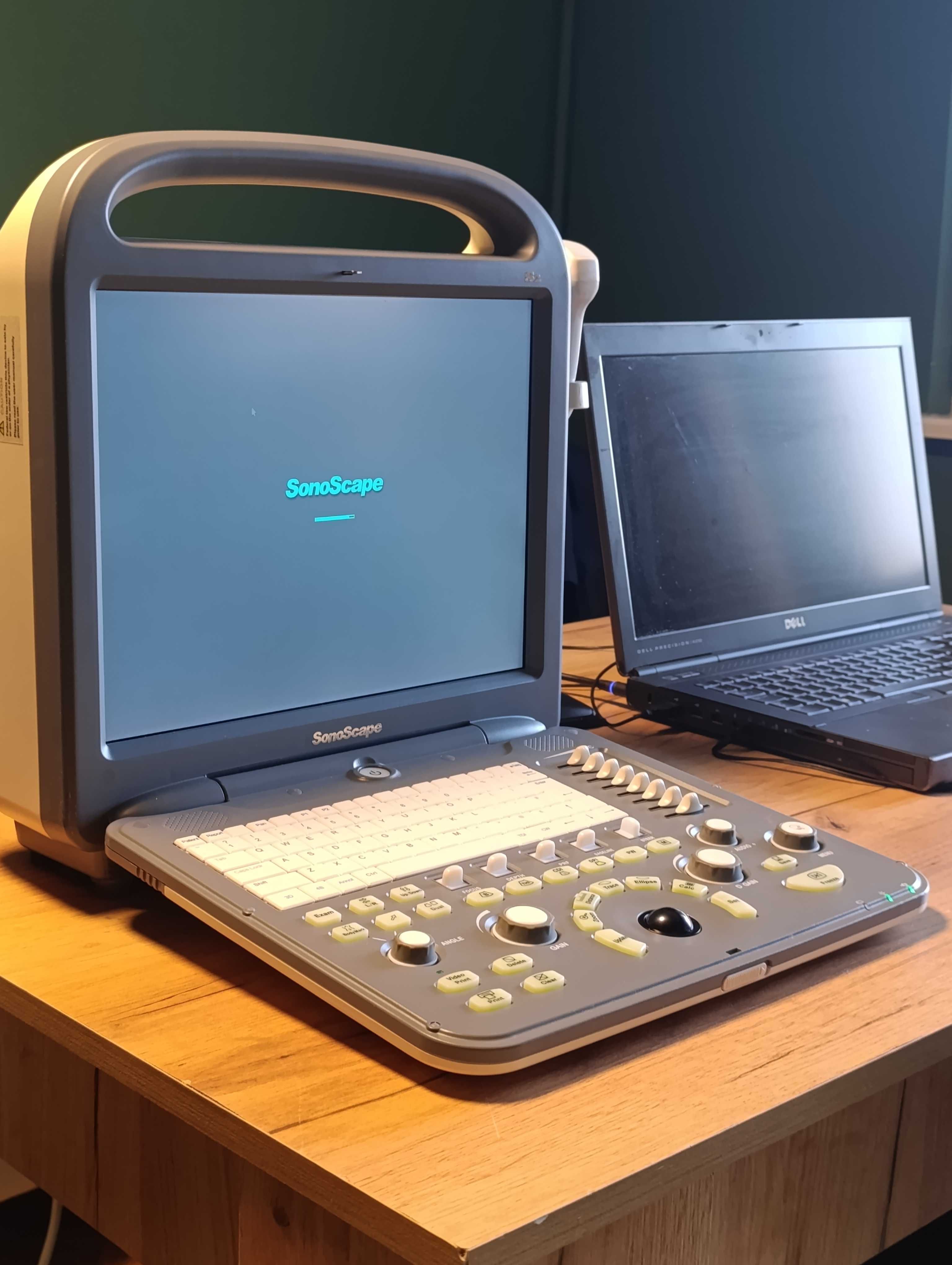 Ехограф SonoScape S2 + конвекс C344