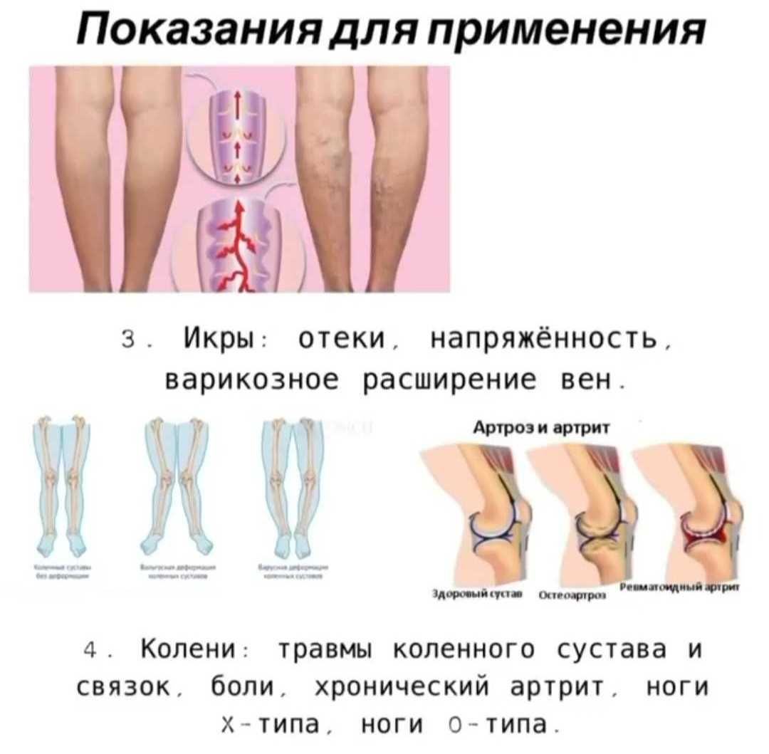 Новые коррекционные ортопедические стельки с бесплатной доставкой!