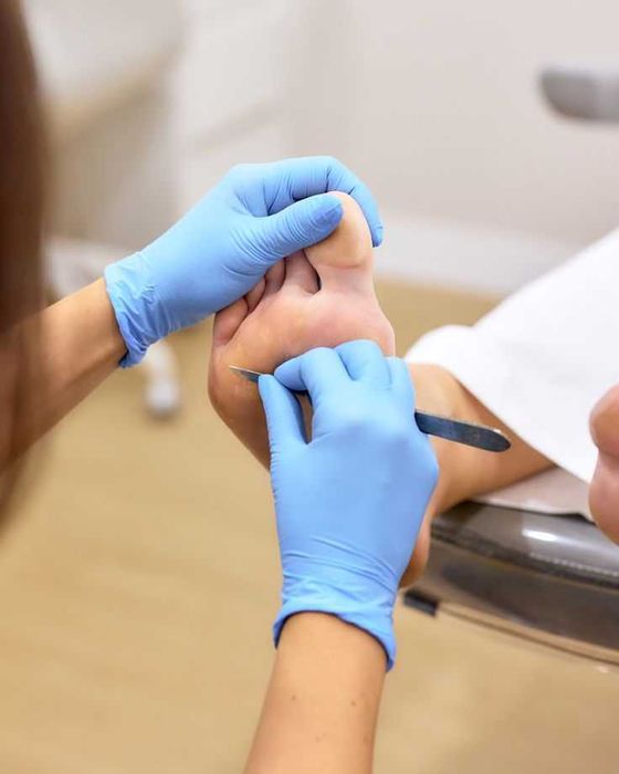 Pedichiură medicală Târgu Mureș