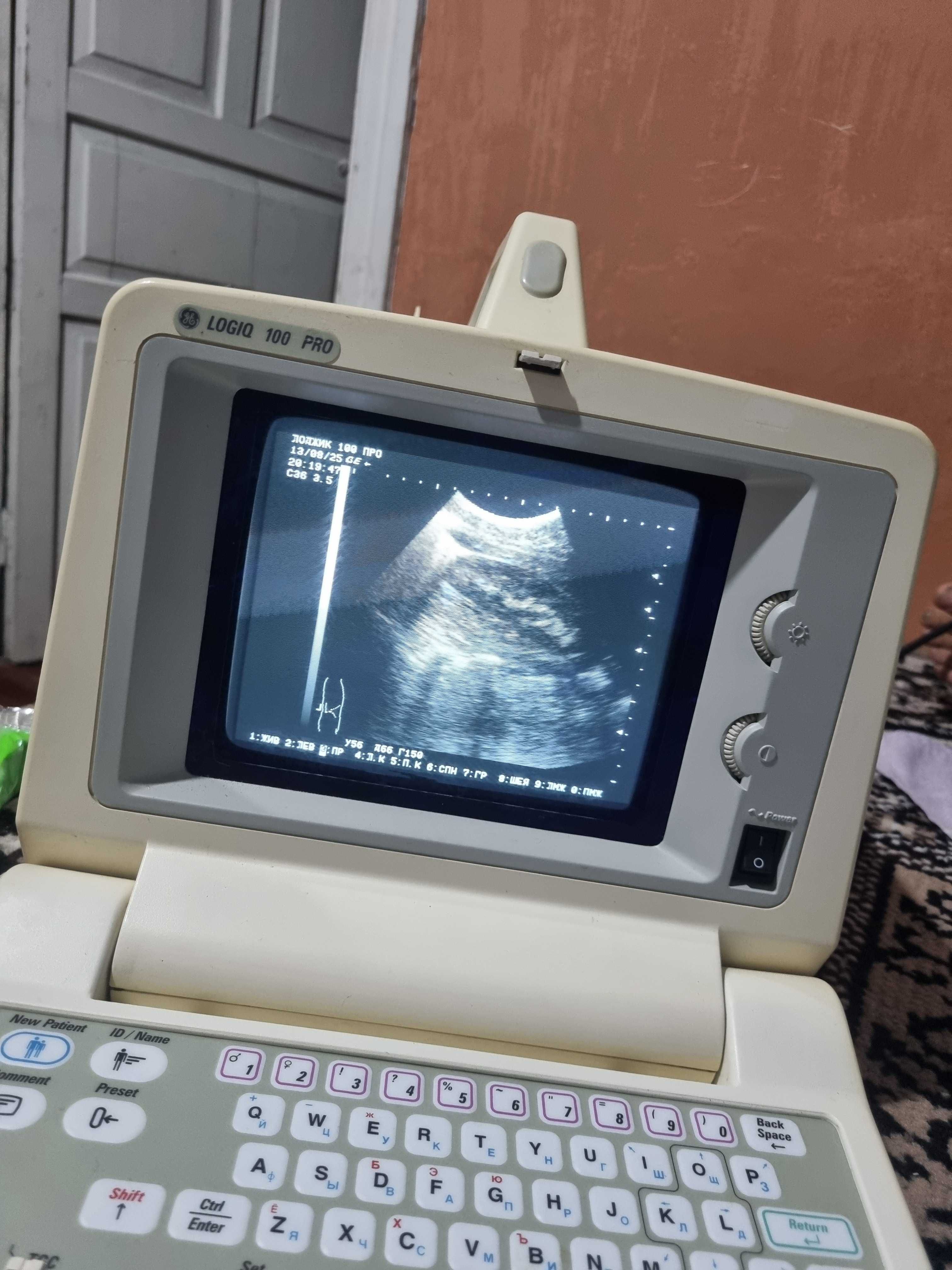 Uzi apparat GE logiq 100 pro
