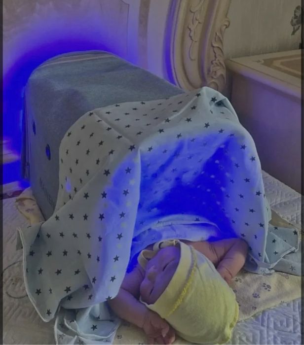 990тг/Фотолампа/Бесплатно доставим\желтуха/аренда\прокат/сарғыш\сары