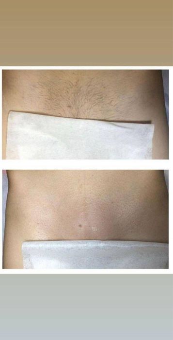 Depilyatsa hizmati uyingizda