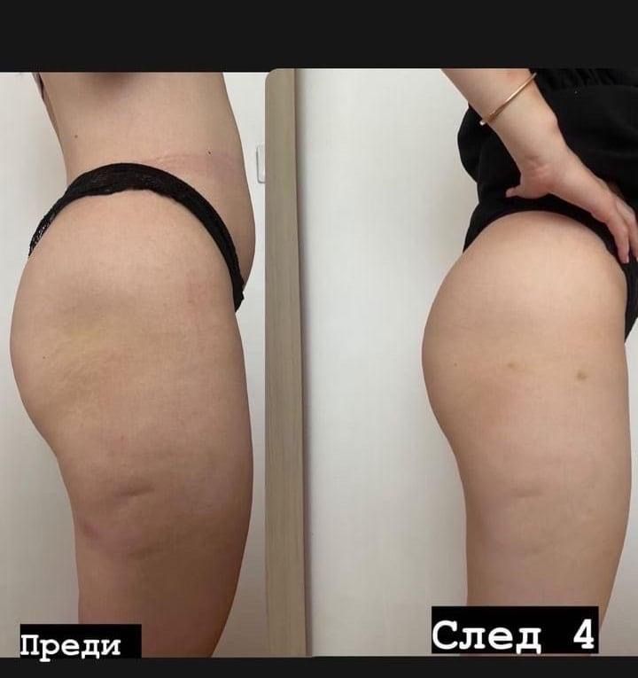 EMS BODY SCULPT Машина за отслабване фитнес стягане