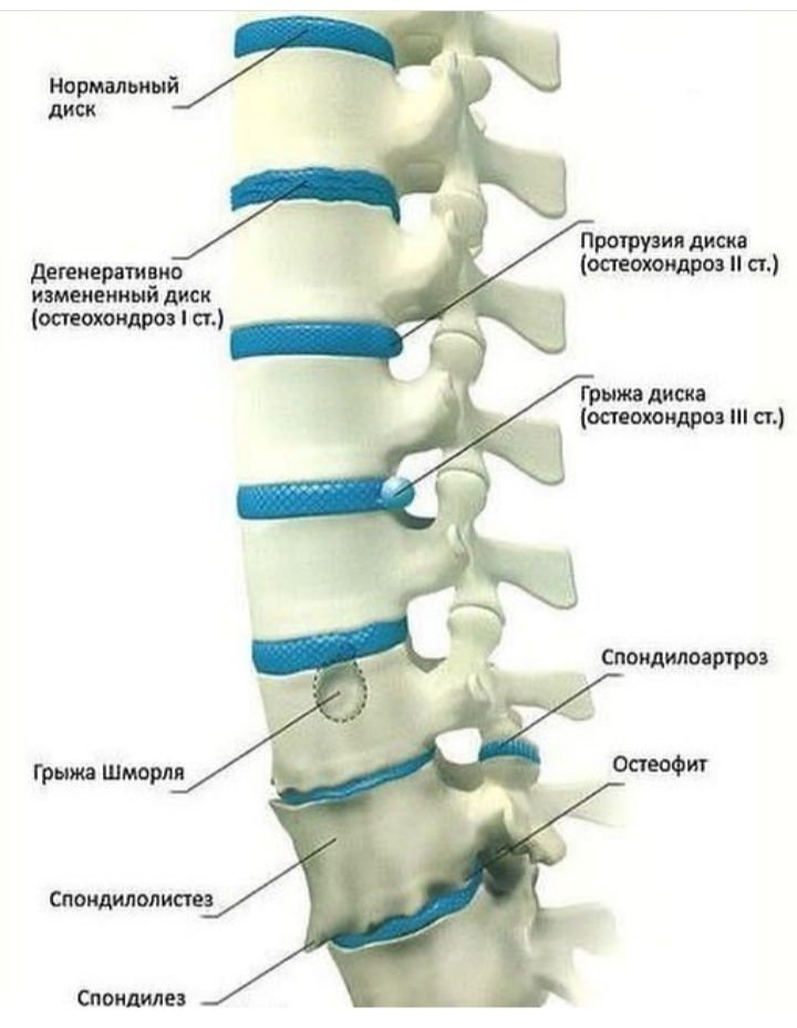 СЫНЫҚШЫ.  Костоправ