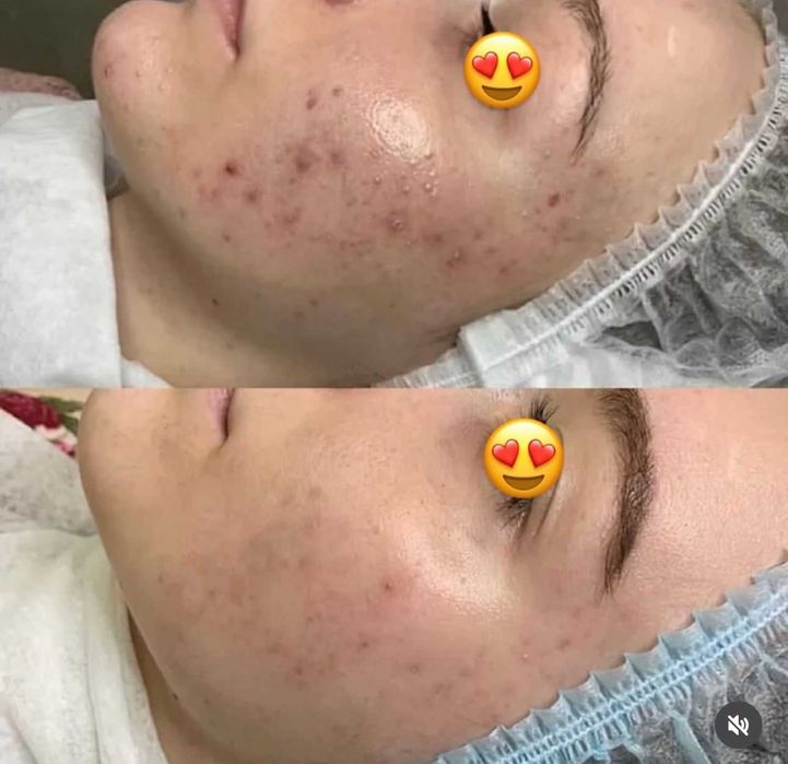 Услуги косметолога шымкент