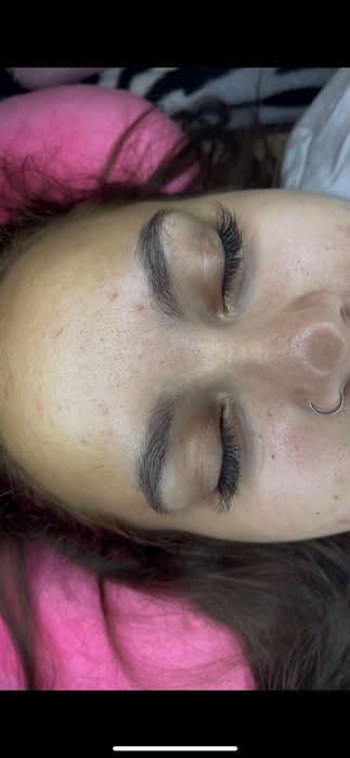 1-3d Gene fir cu fir