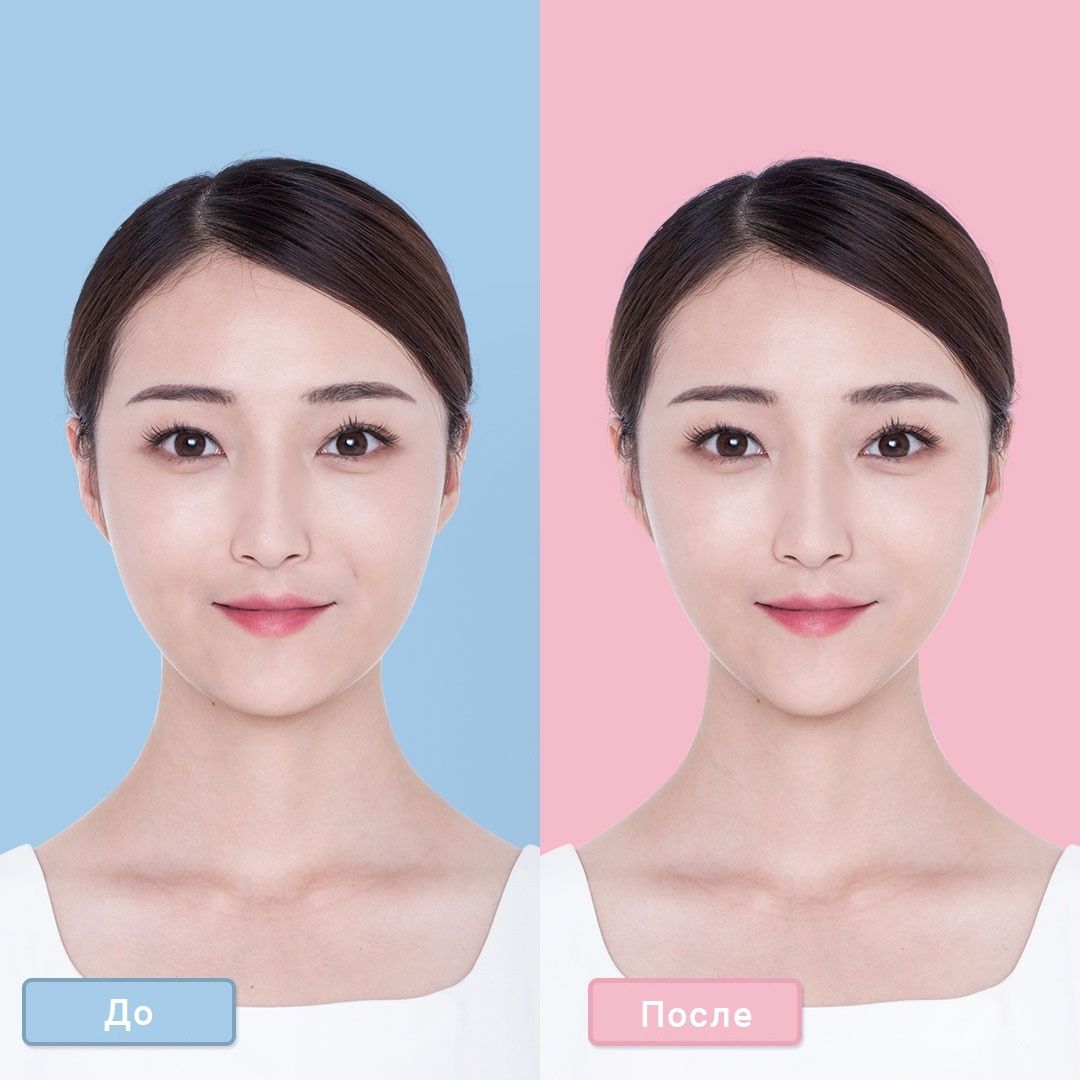 Прибор для RF-лифтинга лица и тела Xiaomi InFace RF Beauty Instrument
