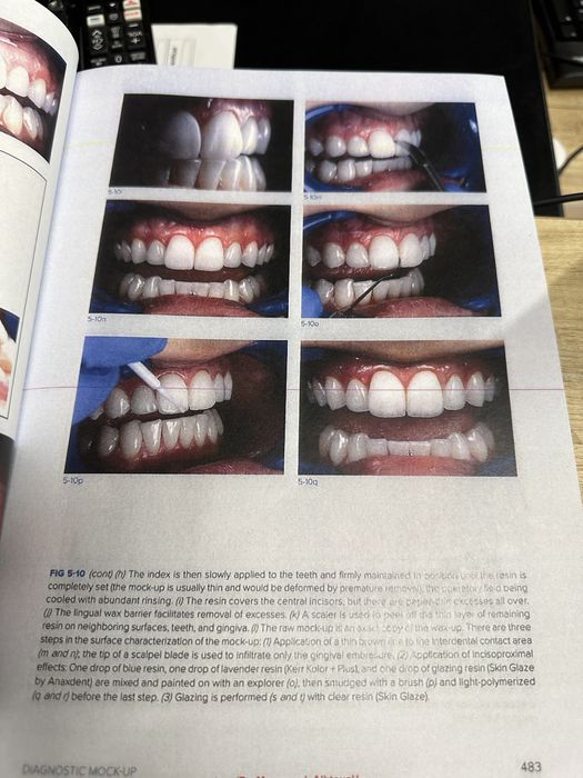 Biomimetic Restorative Dentistry Volume 2 Pascal Magne Urs Belser