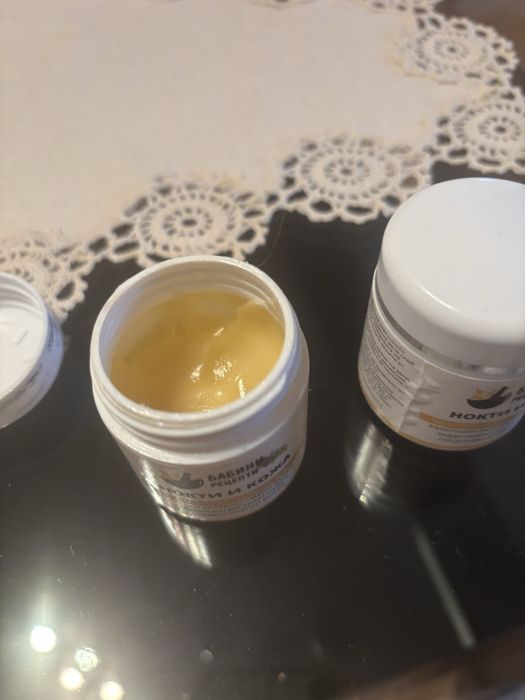 Гъбички по нокти. Крем и още нещо