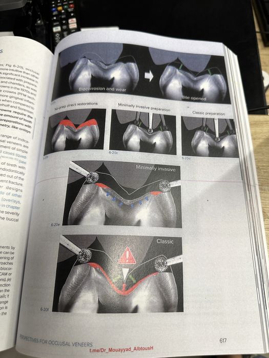 Biomimetic Restorative Dentistry Volume 2 Pascal Magne Urs Belser