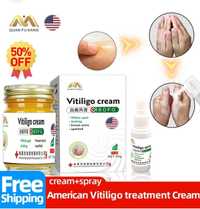 Vitiligo cream эффективный