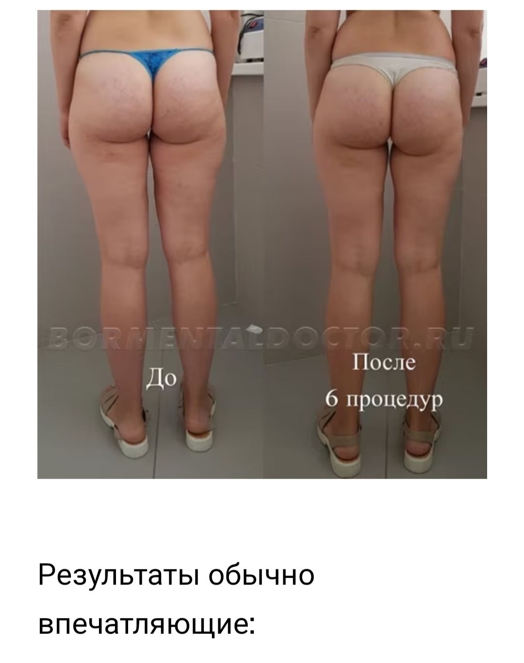 Эндосфера Тело и Лицо массаж