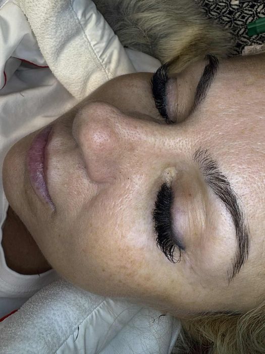 Aplic gene fir cu fir