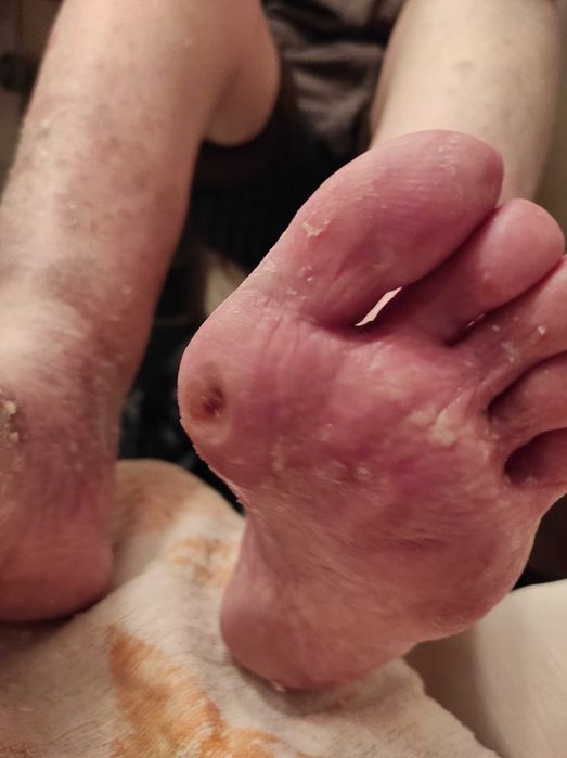 Медицински педикюр по домовете