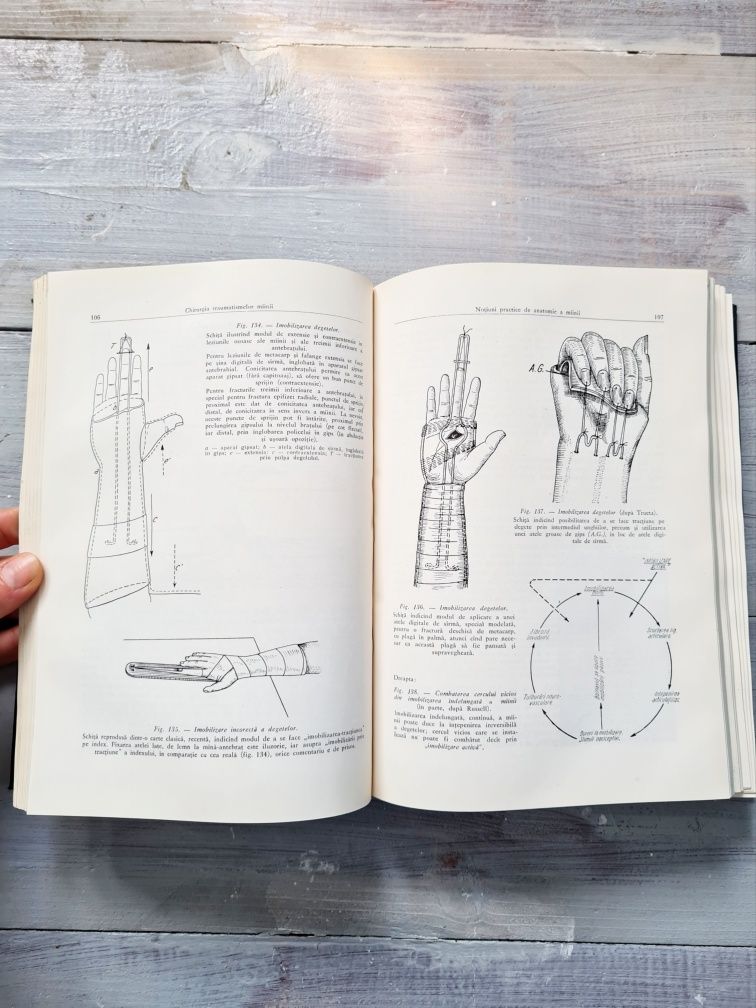 Chirurgia traumatismelor mainii T. Teodorescu P. Bors