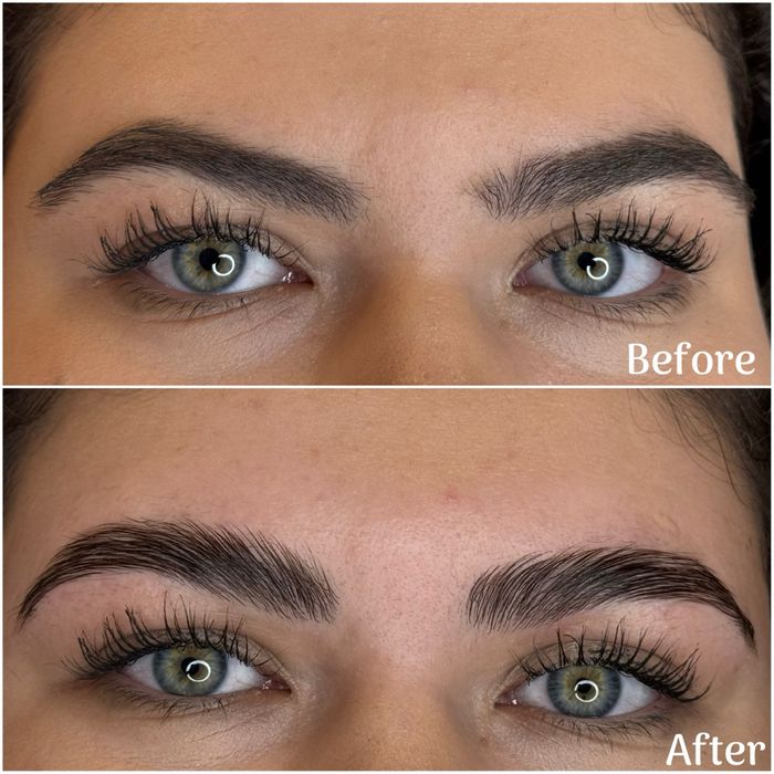 Laminare gene si sprancene