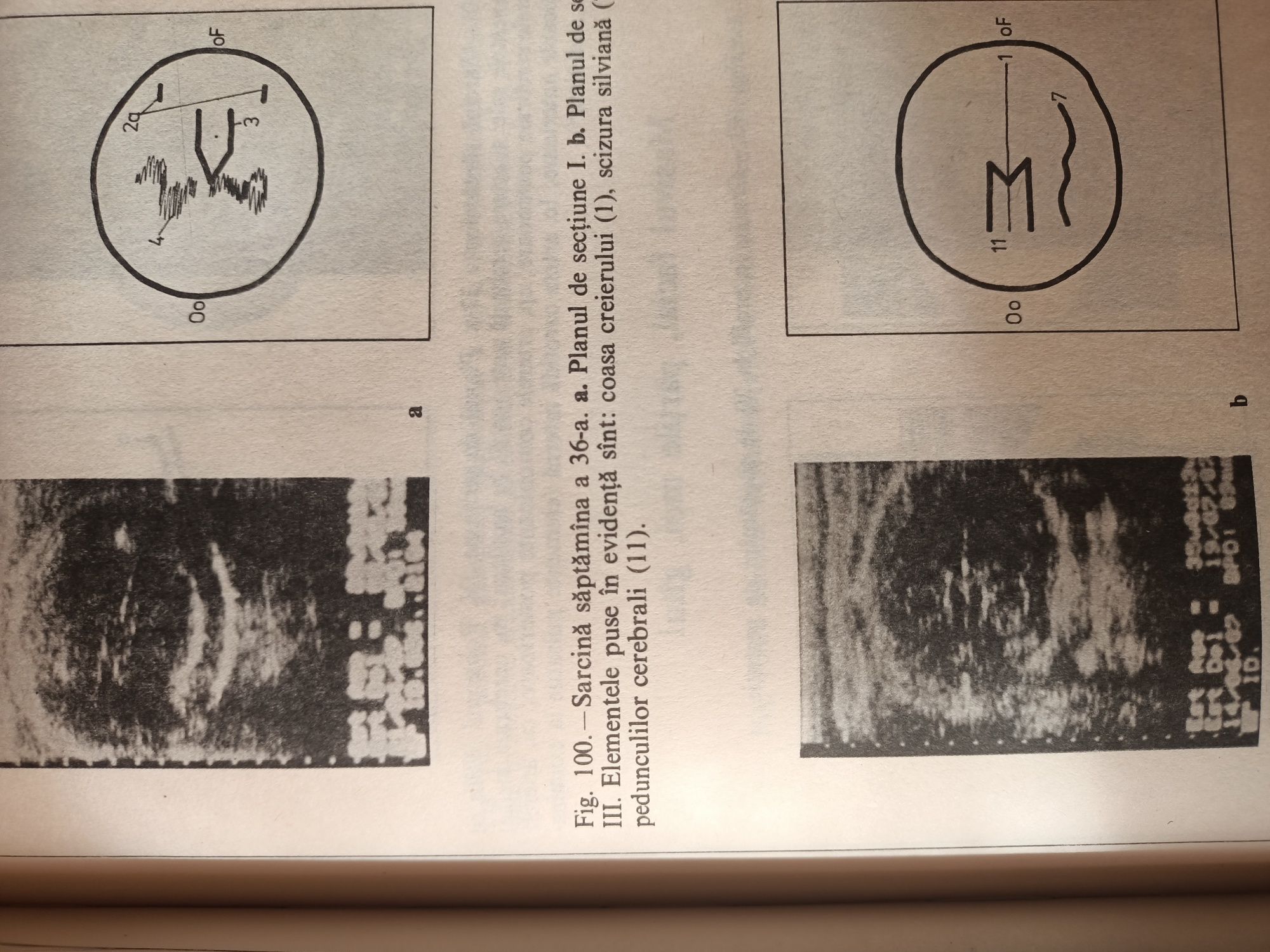 Atlas de Ecografie , Obstetrică