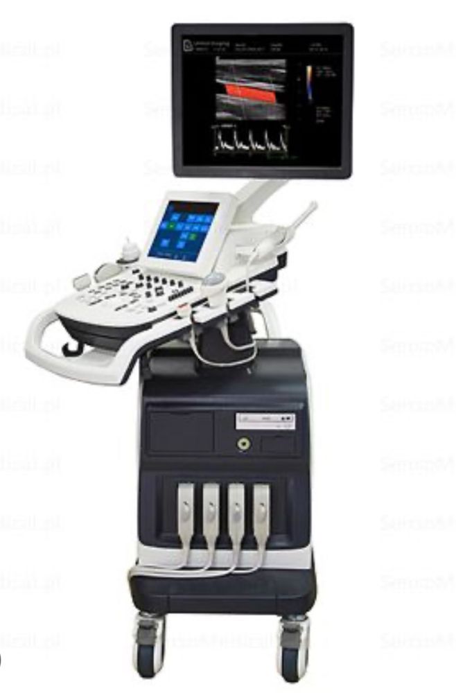 УЗИ-сканер IuStar 300 United Imaging Healthcare