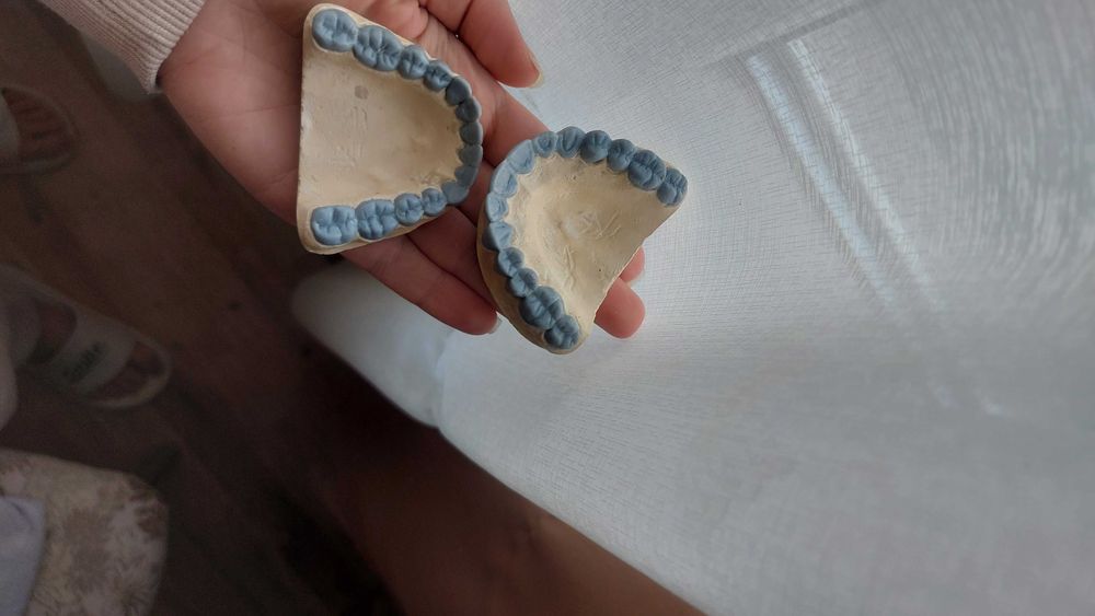 Продавам моделирани зъби 100лв