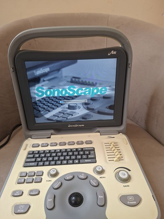 Портативен ултразвуков апарат Sonoscape A6
Мод