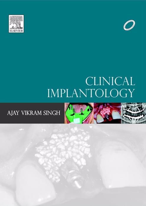 Clinical Implantology - Ajay Vikram Singh - 1st Edition