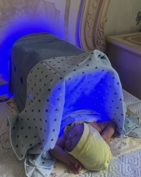 ФОТОЛАМПА от желтушки Сарығыш балаларға кювез для новорожденых