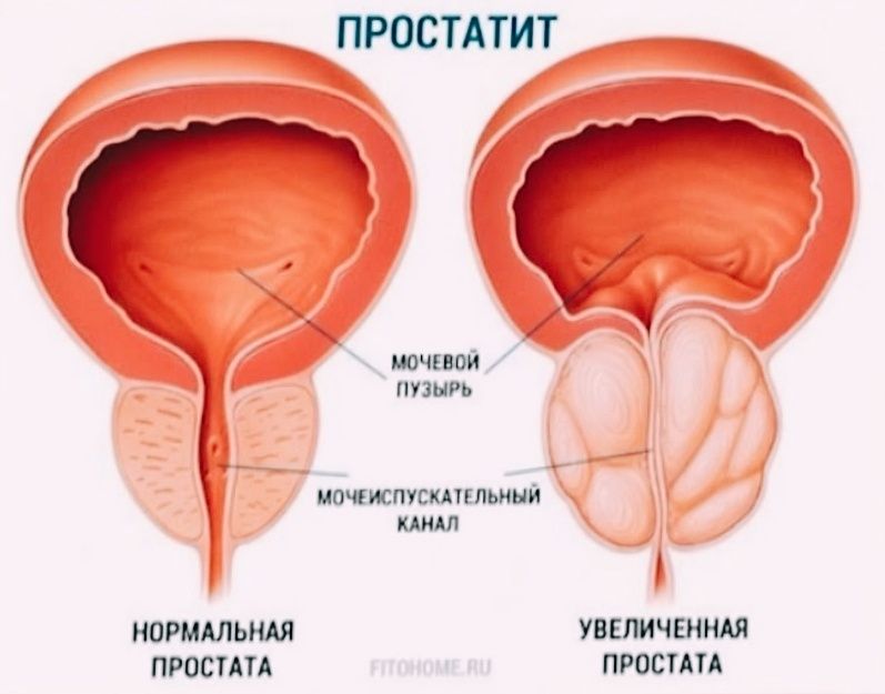 Лечебный массаж Атырау