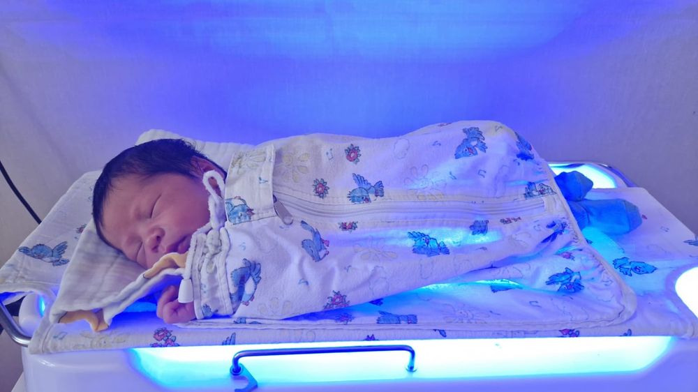 Билитест. Лампа от желтухи желтушки фотолампа Аксион