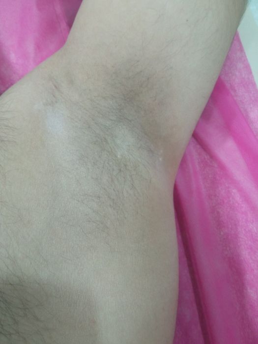 Депиляция мужская и женская