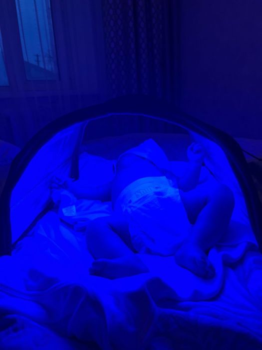 Фотолампа от желтухи новорожденных Экибастуз 1000 тг сутки