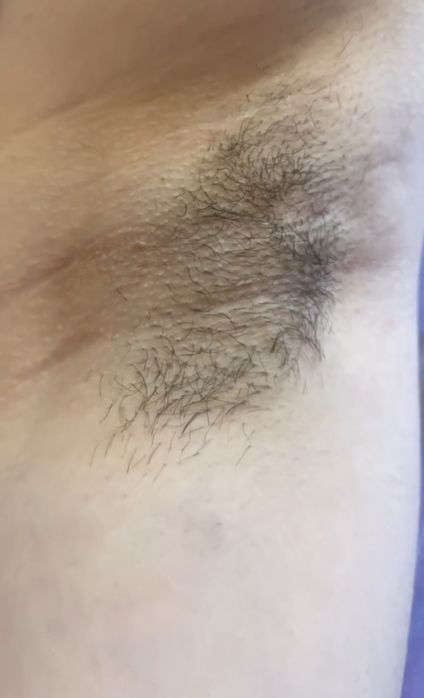 Шугаринг с выездом на дом.