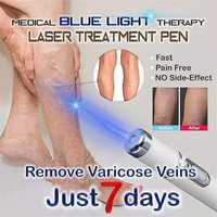 Лазерная ручка для варикоза