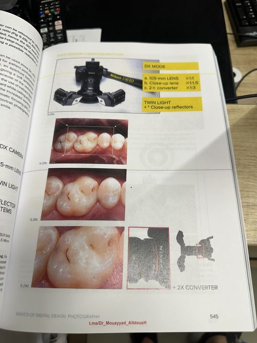 Biomimetic Restorative Dentistry Volume 2 Pascal Magne Urs Belser
