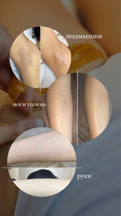 Шугаринг сахарной пастой Астана