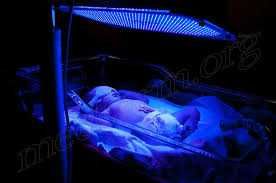 Uy sharoitida fotolampa bilan sariqlikka barham bering