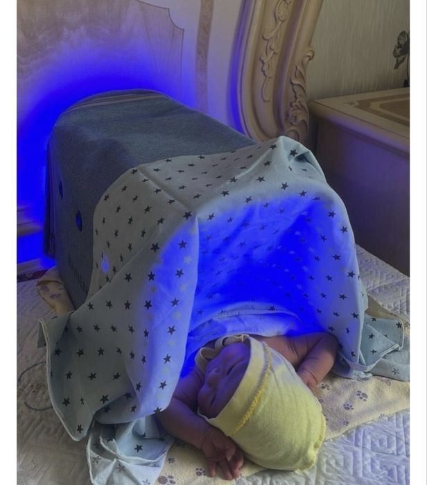 Фотолампа от желтушки 14.990