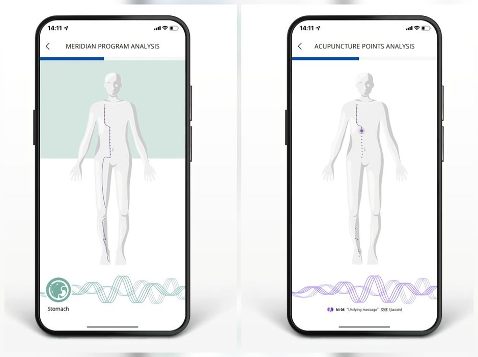 MagHealy PRO - Tehnologie Biofeedback Quantic-Magnetic SI Acupunctura