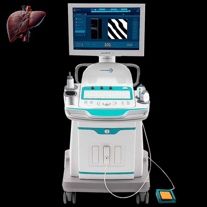 Стоматологический Томограф, Стом Рентген, Фиброскан