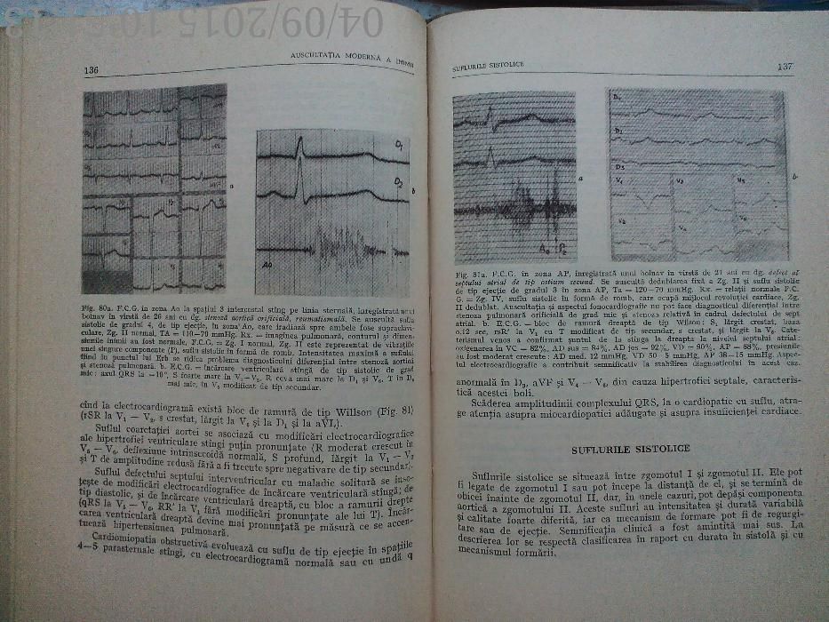 Auscultatia moderna a inimii Stefan Haragus-Ioan Zagreanu, 1974