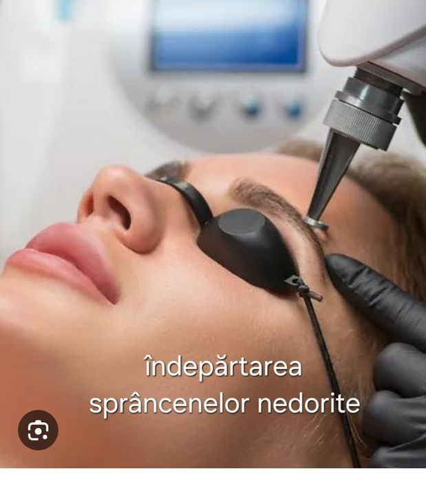 Îndepărtare tatuaj cu laser