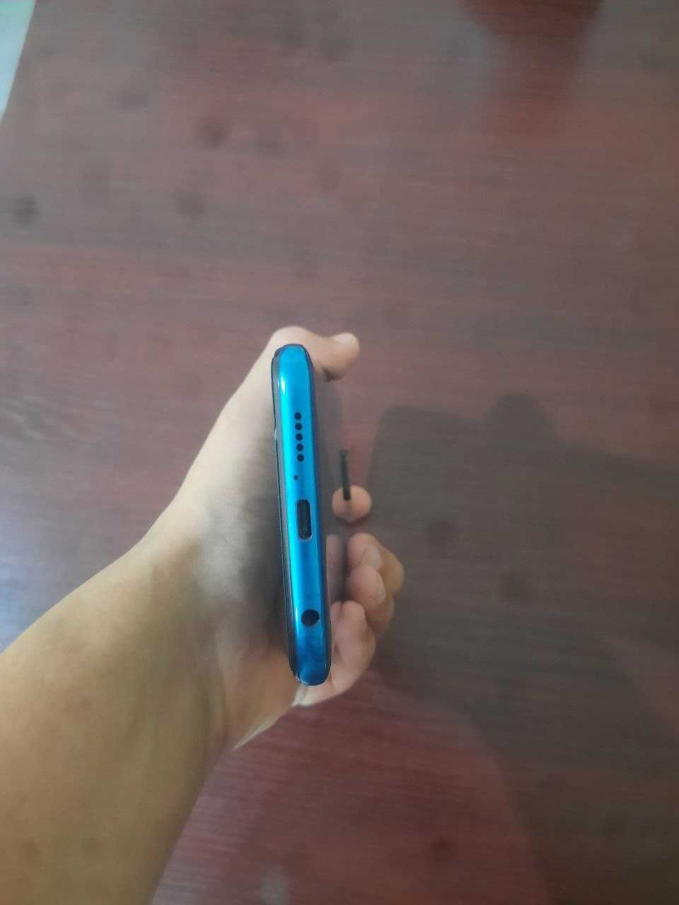 Redmi Note 9s, holati zo'r