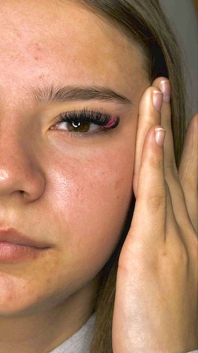 Extensii  gene fir cu fir