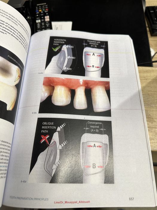 Biomimetic Restorative Dentistry Volume 2 Pascal Magne Urs Belser