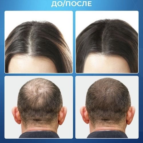 Руското чудо Зсвицин е тук