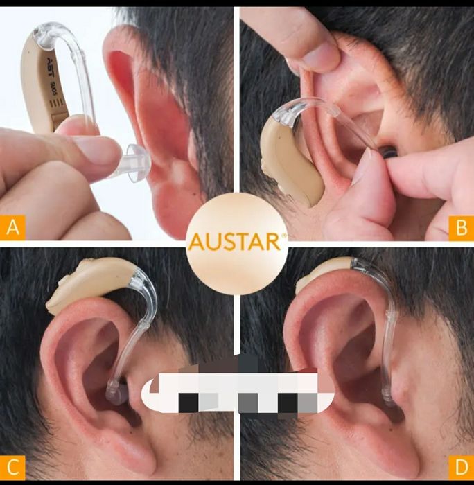 Слуховой аппарат, Для 4 степени потери слуха. Цифровой (superpower)