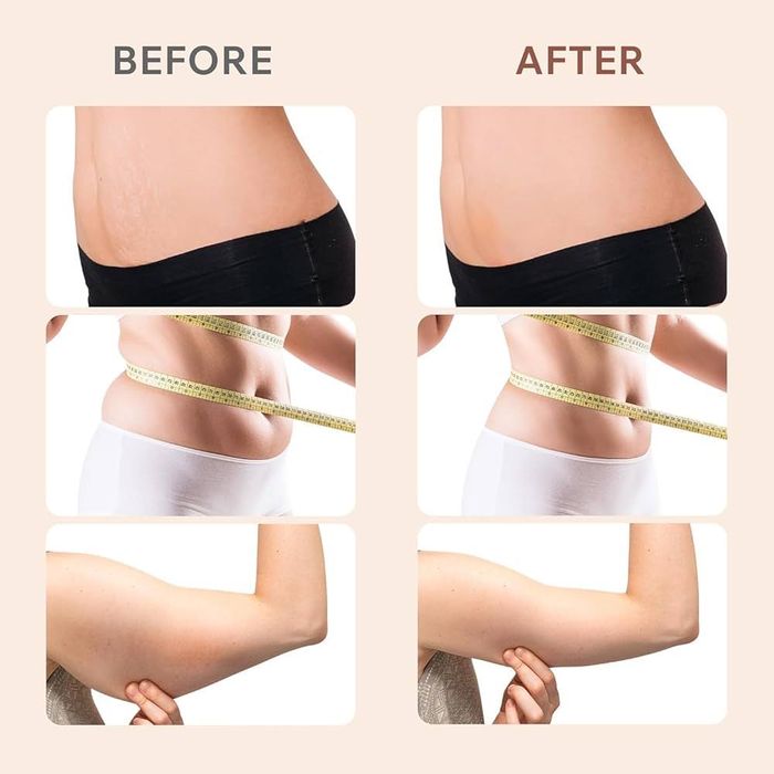 Антицелулитен масажор Robofun 6 в 1 За стягане и изглаждане на кожата