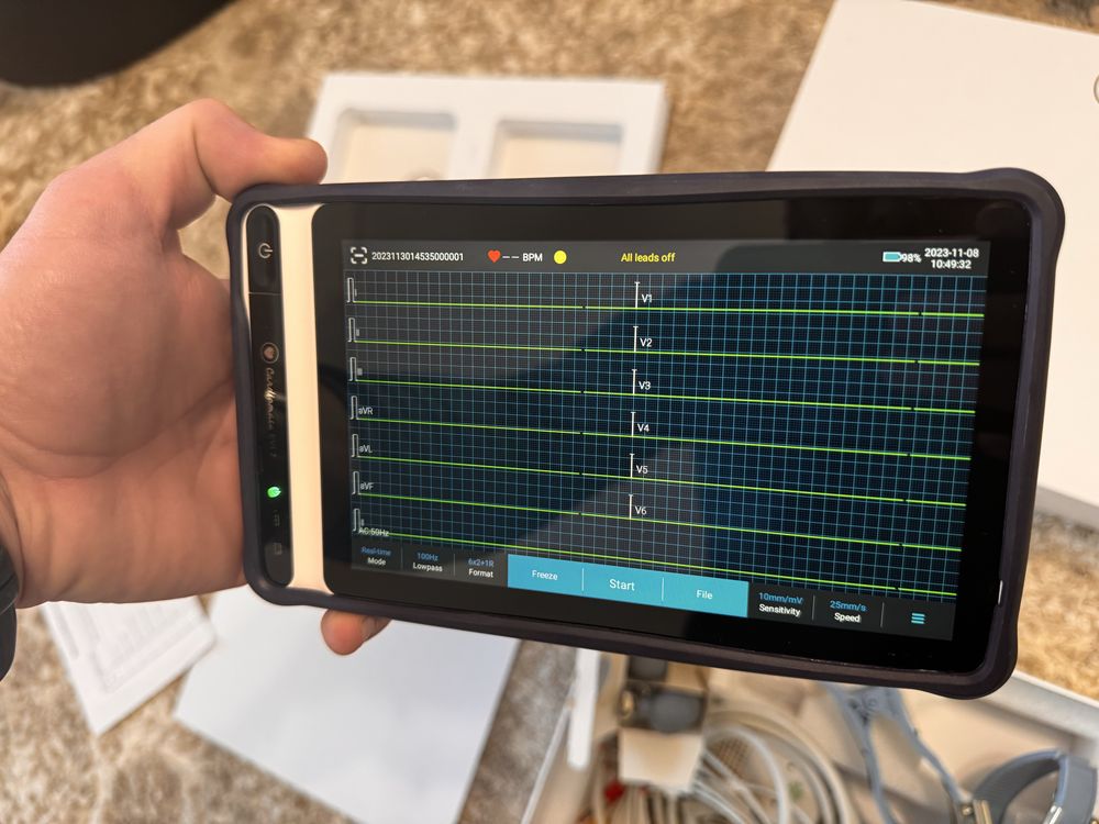 Aparat EKG electrocardiograf spengler cardiomate 7 nou cu interpretare