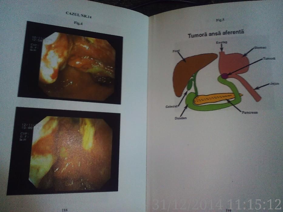 Gastroenterologia in practica medicala ,M. DICULESCU, 2005